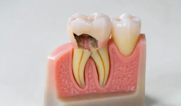 Comparison chart of gum graft costs by type and insurance coverage