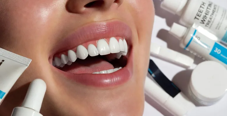 Beautiful smile with porcelain veneers